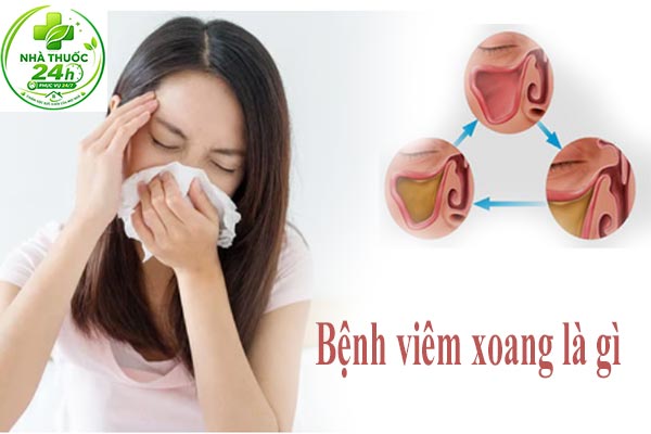 viêm xoang